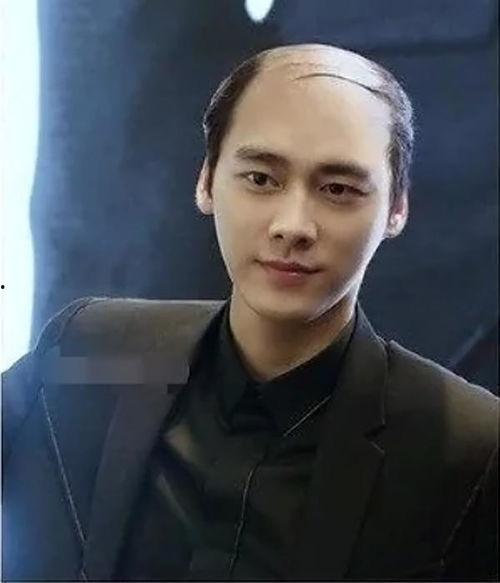 淄川网红秃头男,淄川男生的网络传奇